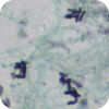 Geotrichum candidum reproduces by segmentation of hyphae into arthrospores.