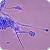 Gibberella moniliformis picture