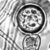 Phytophthora image